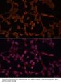 Bile Salt Export Pump (ABCB11) Antibody