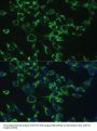 Cytochrome C Oxidase Subunit 5B (COX5B) Antibody