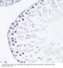 Fibroblast Growth Factor 12 (FGF12) Antibody
