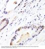 Fibroblast Growth Factor 12 (FGF12) Antibody