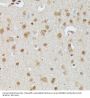 DNA-Binding Protein SMUBP-2 (IGHMBP2) Antibody
