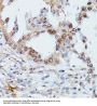 DNA-Binding Protein SMUBP-2 (IGHMBP2) Antibody