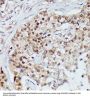 DNA-Binding Protein SMUBP-2 (IGHMBP2) Antibody