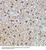 DNA-Binding Protein SMUBP-2 (IGHMBP2) Antibody