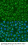 Phosphatidylinositol-4-Phosphate 5-Kinase Type 1 Beta (PIP5K1B) Antibody