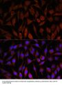 E3 Ubiquitin-Protein Ligase NEDD4-Like (NEDD4L) Antibody