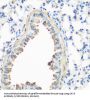 Caveolin 3 (CAV3) Antibody