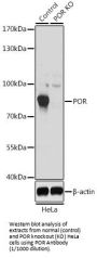 NADPH-Cytochrome P450 Reductase (POR) Antibody