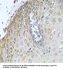 NADPH-Cytochrome P450 Reductase (POR) Antibody
