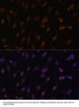 NADPH-Cytochrome P450 Reductase (POR) Antibody