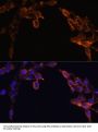 NADPH-Cytochrome P450 Reductase (POR) Antibody