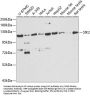 Serine/threonine-Protein Kinase SIK2 (SIK2) Antibody
