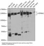Presequence Protease, Mitochondrial (PITRM1) Antibody