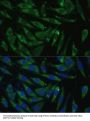 Presequence Protease, Mitochondrial (PITRM1) Antibody