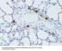 Transcription Elongation Factor, Mitochondrial (TEFM) Antibody