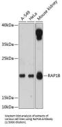 RAS-Related Protein RAP1B (RAP1B) Antibody