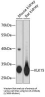 Kallikrein Related Peptidase 15 (KLK15) Antibody
