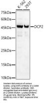 m7GpppN-mRNA Hydrolase (DCP2) Antibody