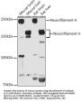 Neurofilament Heavy Polypeptide (NEFH) Antibody