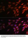 Neurofilament Heavy Polypeptide (NEFH) Antibody
