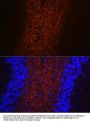 Neurofilament Heavy Polypeptide (NEFH) Antibody