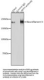 Neurofilament Heavy Polypeptide (NEFH) Antibody