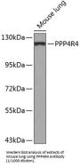 Serine/threonine-Protein Phosphatase 4 Regulatory Subunit 4 (PPP4R4) Antibody