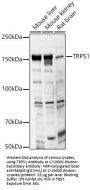 Zinc Finger Transcription Factor TRPS1 (TRPS1) Antibody