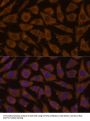 Myotubularin Related Protein 4 (MTMR4) Antibody