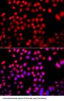 Cofilin 2 (CFL2) Antibody