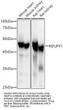 NADH Ubiquinone Oxidoreductase Core Subunit V1 (NDUFV1) Antibody