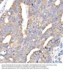 NADH Ubiquinone Oxidoreductase Core Subunit V1 (NDUFV1) Antibody