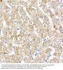 NADH Ubiquinone Oxidoreductase Core Subunit V1 (NDUFV1) Antibody