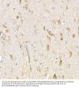 NADH Ubiquinone Oxidoreductase Core Subunit V1 (NDUFV1) Antibody