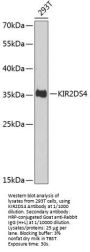 Killer Cell Immunoglobulin Like Receptor 2DS4 (KIR2DS4) Antibody