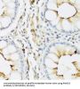 Eosinophil Cationic Protein / ECP (RNASE3) Antibody