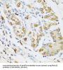 Eosinophil Cationic Protein / ECP (RNASE3) Antibody
