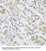 Resistin (RETN) Antibody