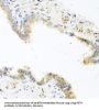 Resistin (RETN) Antibody
