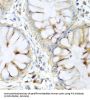 Elafin (PI3) Antibody