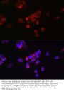 Fibroblast Growth Factor 23 (FGF23) Antibody