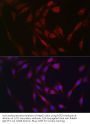 Fibroblast Growth Factor 23 (FGF23) Antibody