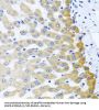 Cation Dependent Mannose 6-Phosphate Receptor (M6PR) Antibody