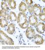 Cation Dependent Mannose 6-Phosphate Receptor (M6PR) Antibody