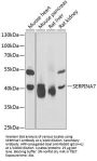 Thyroxine Binding Globulin / TBG (SERPINA7) Antibody
