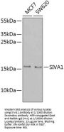 Apoptosis Regulatory Protein Siva / CD27BP (SIVA1) Antibody