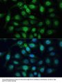 ZW10 Interactor (ZWINT) Antibody