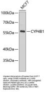 Cytochrome P450 4B1 (CYP4B1) Antibody