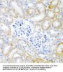 Prorelaxin H2 (RLN2) Antibody