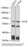 Protein SSXT (SS18) Antibody